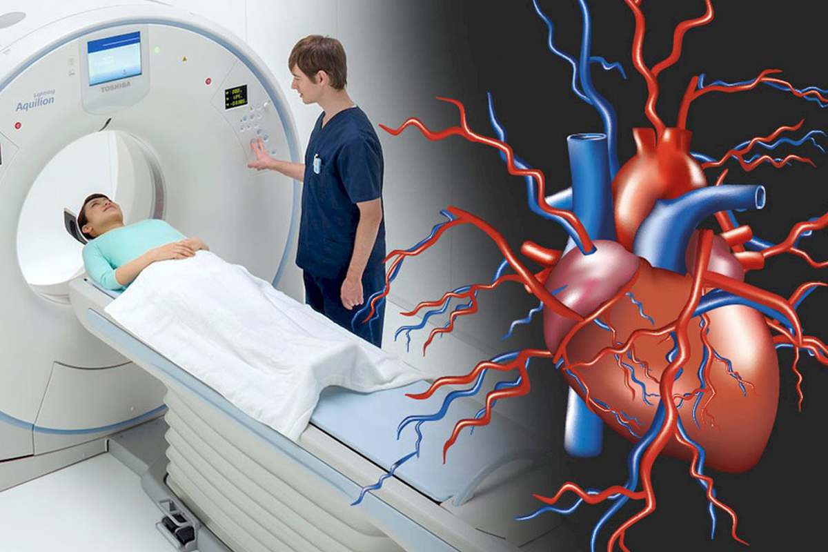 BT Anjiyo ve Görüntüleme Testleri