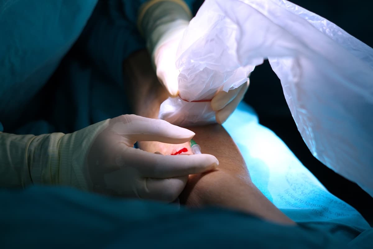 El Bileğinden Anjiyo