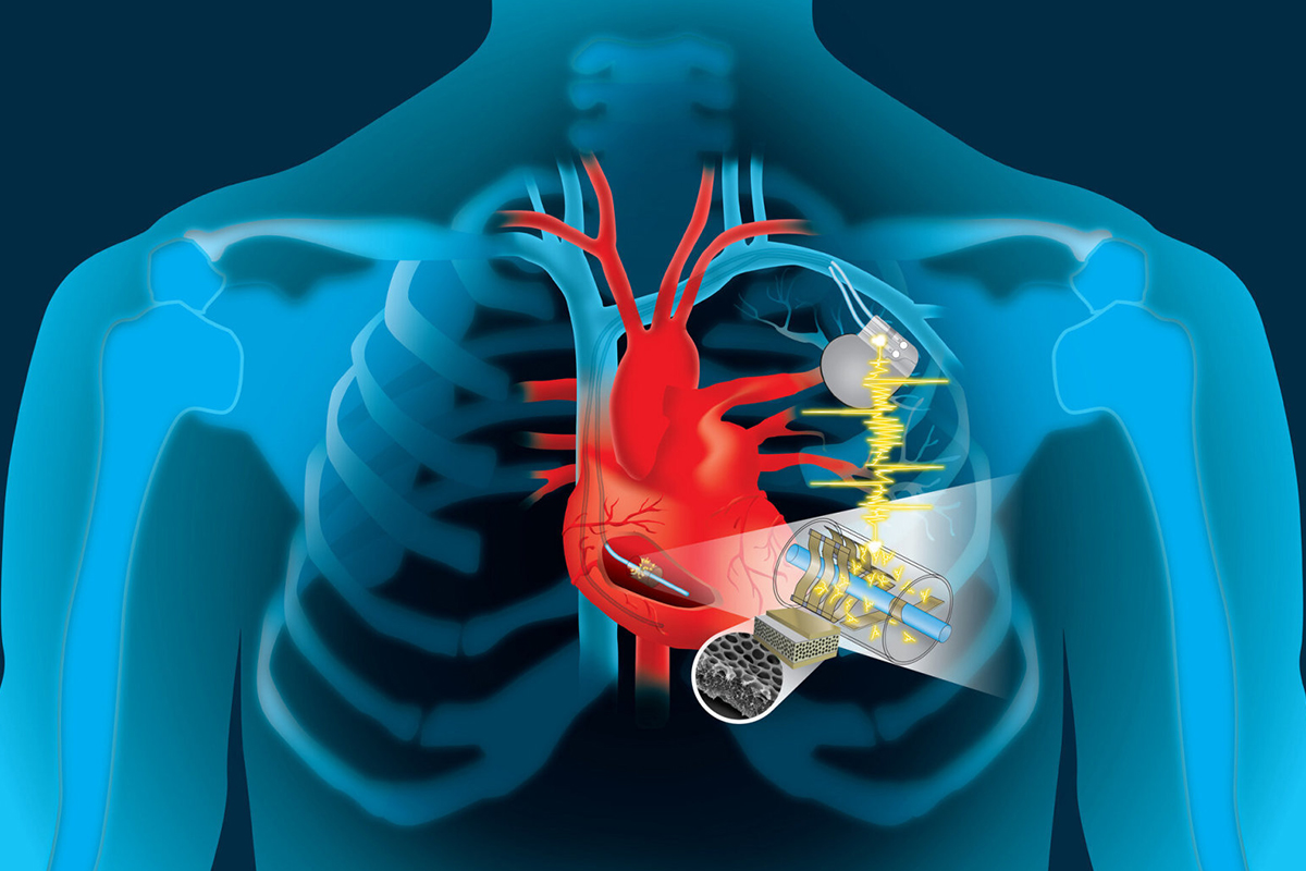Kalp Pili Uygulamaları